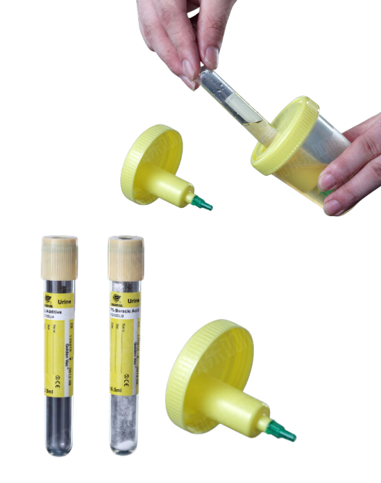 Urine Container Kit /w Needle